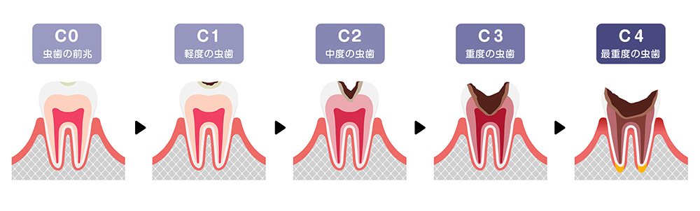 歯が痛い