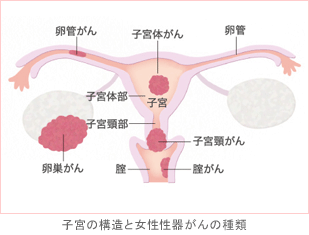子宮の構造と女性性器がんの種類